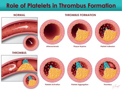 Role of Platelets